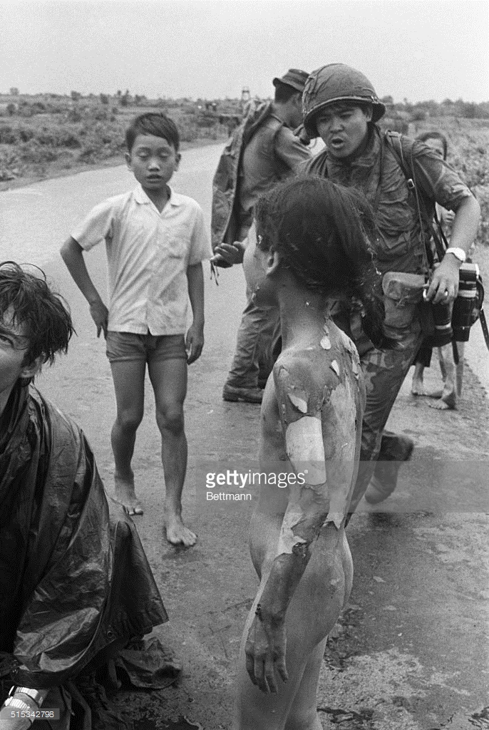“Em bé napalm” Phan Thị Kim Phúc ngày ấy, bây giờ